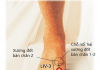 9 bộ phân cơ thể có sự liên kết bởi huyệt đạo ở bàn chân