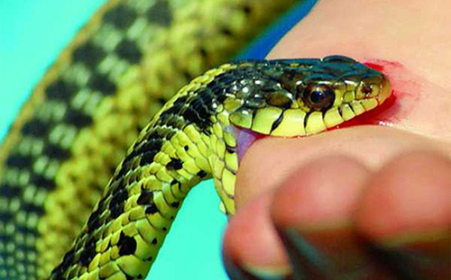 Vết cắn do rắn độc cắn vô cùng nguy hiểm